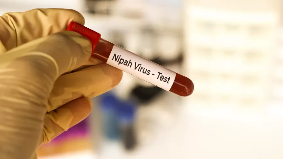 virus nipah cronica.jpg