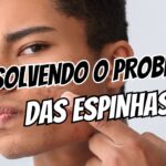 Acne piora com calor e suor ajuste a rotina sem gastar muito