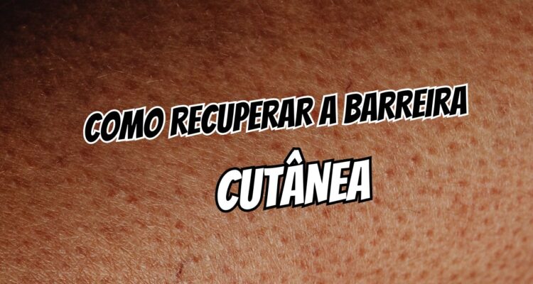 Pele ardendo Como recuperar a barreira cutânea sem gastar muito